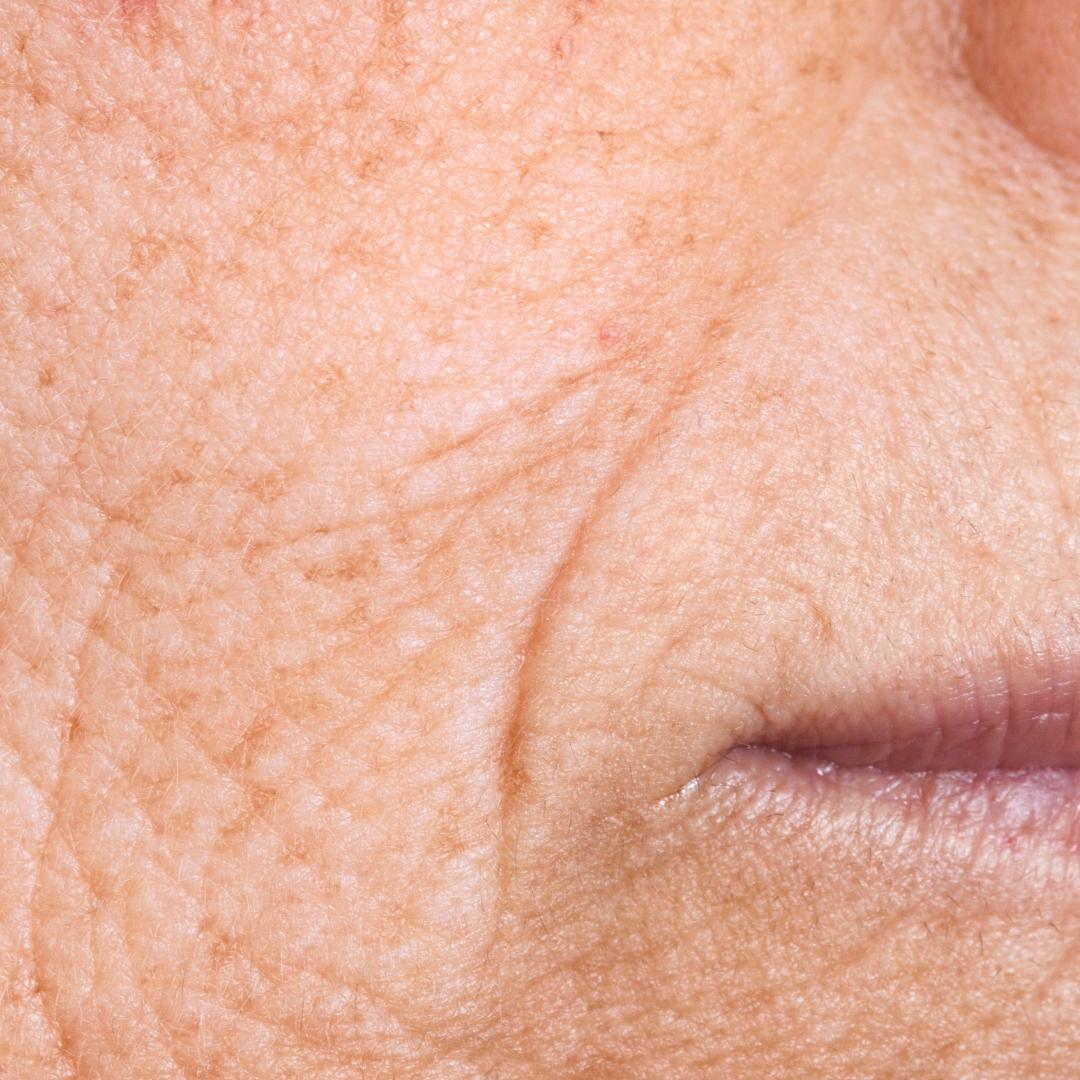 Wrinkles Closeup